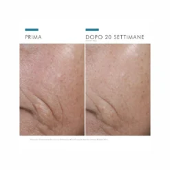 Skin Ceuticals SkinCeuticals C E Ferulic Trattamento Viso Antiossidante Alla Vitamina C 30 Ml -Galenia shop skinceuticals prevent ce ferulic siero antiossidante 30ml 4 1665657440